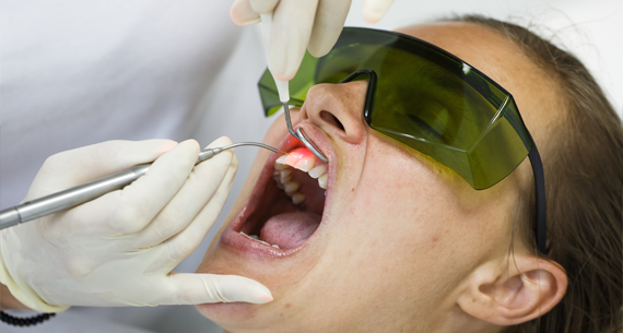 Láser dental en Cñínica Dental Tecnologie Perú